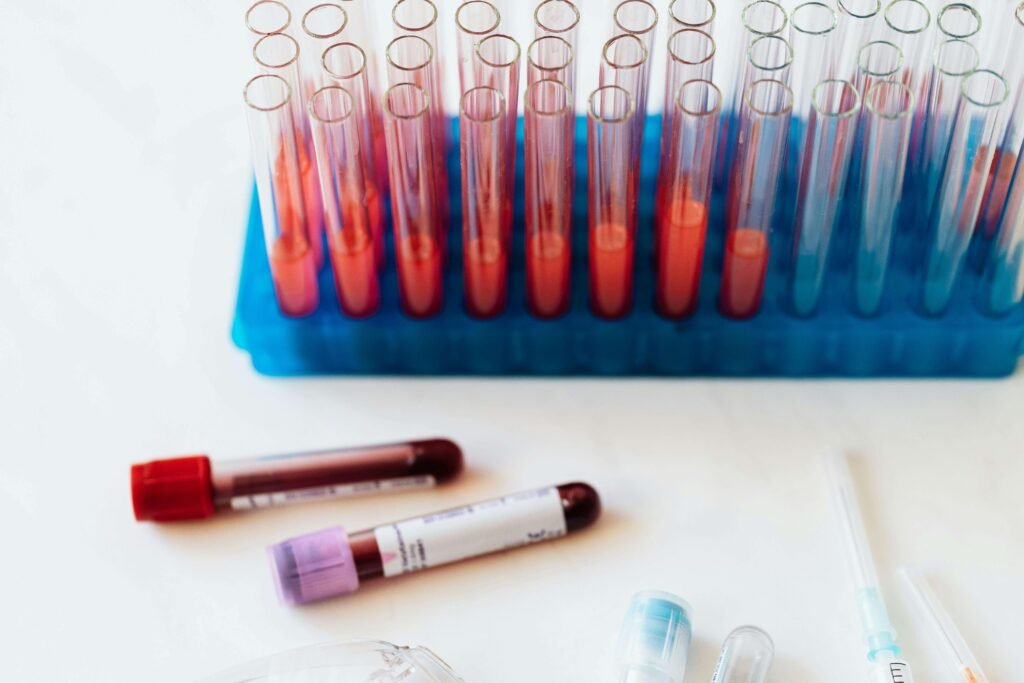 Triglicerídeos: Guia para baixar e fortalecer sua Saúde Cardiovascular 1 Triglicerídeos